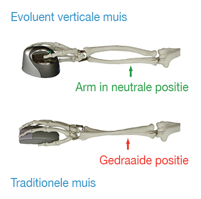 RSI is te voorkomen met de juiste armpositie.